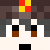 vavalixMCPVP