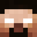 NitroFingers
