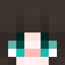 DownSyndromeKid