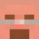 Hyperso