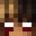 Nyrezz1