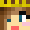 lozzle_m